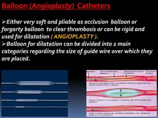 Balloon (Angioplasty) Catheters
Either very soft and pliable as occlusion balloon or
forgarty balloon to clear thrombosis or can be rigid and
used for dilatation ( ANGIOPLASTY ).
Balloon for dilatation can be divided into 2 main
categories regarding the size of guide wire over which they
are placed.
 