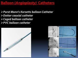 Porst Mann’s Korsetts balloon Catheter
Dotter coaxial catheter
Caged balloon catheter
PVC balloon catheter
Balloon (Angioplasty) Catheters
 