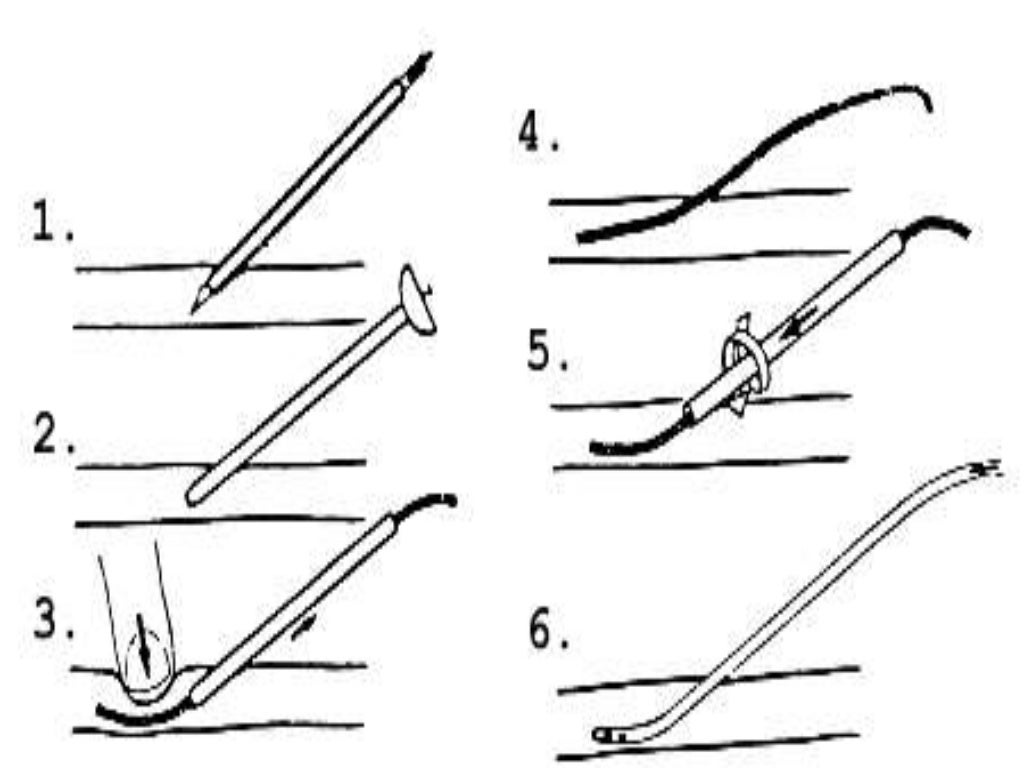 Catheters guidewires