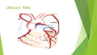 Lima Rima Rib catheters and hardwares - dr praveen.pptx