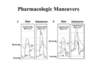 Pharmacologic Maneuvers
 