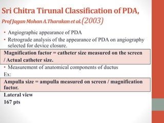 Sri Chitra Tirunal Classification of PDA,
ProfJaganMohanA.Tharakanetal.(2003)
• Angiographic appearance of PDA
• Retrograde analysis of the appearance of PDA on angiography
selected for device closure.
Magnification factor = catheter size measured on the screen
/ Actual catheter size.
• Measurement of anatomical components of ductus
Ex:
Ampulla size = ampulla measured on screen / magnification
factor.
Lateral view
167 pts
 