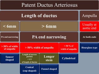 Patent Ductus Arteriosus
Length of ductus
< 6mm
PA end narrowing
> 50% of width
of ampulla
Saucer
shaped
> 6mm
PA end narrowing
> 50% width of ampulla
Length of narrow
portion
< 1/3
of length of ductus
Conical
(cup shaped)
Longer
stem
Funnel shaped
< 50 % of
width of ampulla
Cylindrical
Ampulla
Usually at
aortic end
At both ends
Hourglass type
 