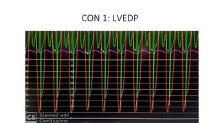 CON 1: LVEDP