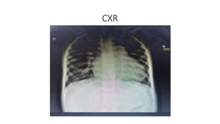 CXR