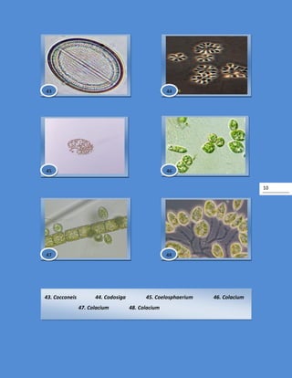 10
43. Cocconeis 44. Codosiga 45. Coelosphaerium 46. Colacium
47. Colacium 48. Colacium
48
4443
45 46
47
 