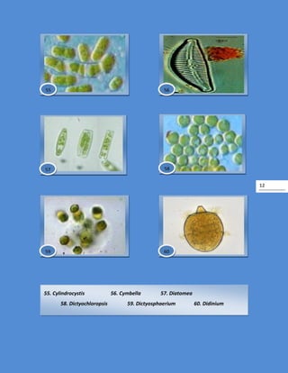 12
55. Cylindrocystis 56. Cymbella 57. Diatomea
58. Dictyochloropsis 59. Dictyosphaerium 60. Didinium
60
5857
5655
59
 