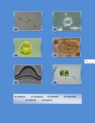 13
61. Dinobryon 62. Distephanus 63. Dunaliella 64. Entamoeba
65. Epithemia 66. Euastrum
61 62
63 64
6665
 