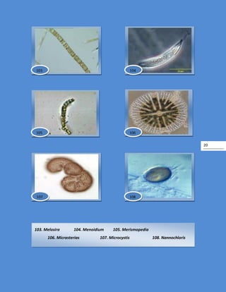 20
103. Melosira 104. Menoidium 105. Merismopedia
106. Micrasterias 107. Microcystis 108. Nannochloris
106
103 104
105
108107
 