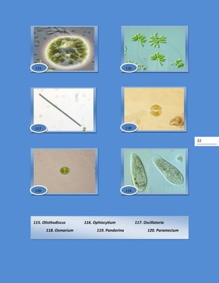 22
115. Olisthodiscus 116. Ophiocytium 117. Oscillatoria
118. Osmarium 119. Pandorina 120. Paramecium
118
119120
117
116115
 