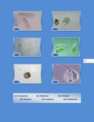 23
121. Paramecium 122. Pediastrum 123. Pelomyxa
124. Peranema 125. Peridinium 126. Petalomonas
124
121 122
123
125 126
 