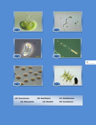 26
139. Pyramimonas 140. Raphidiopsis 141. Rhabdomonas
142. Rhizosolenia 143. Rhodella 144. Scenedesmus
142
139 140
141
143 144
 