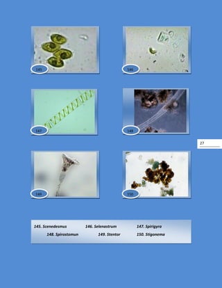 27
145. Scenedesmus 146. Selenastrum 147. Spirigyra
148. Spirostomun 149. Stentor 150. Stigonema
148
145 146
147
149 150
 