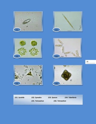 28
151. Suriella 152. Synedra 153. Synura 154. Tabellaria
155. Tetraedron 156. Tetraedron
154
151 152
153
156155
 