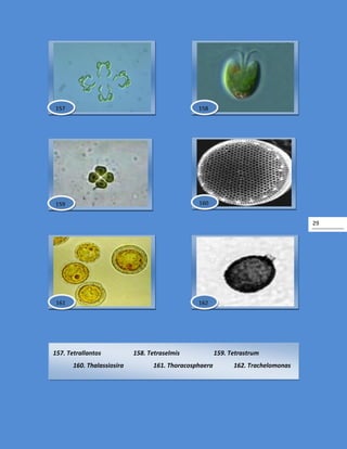 29
157. Tetrallantos 158. Tetraselmis 159. Tetrastrum
160. Thalassiosira 161. Thoracosphaera 162. Trachelomonas
160
162161
159
158157
 