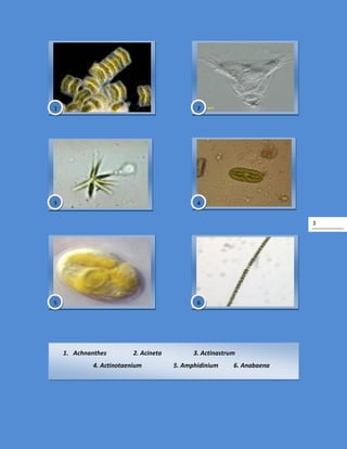 3
1. Achnanthes 2. Acineta 3. Actinastrum
4. Actinotaenium 5. Amphidinium 6. Anabaena
1
65
43
2
 