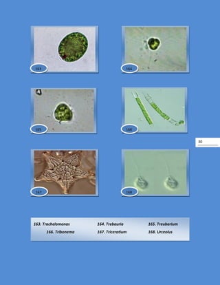 30
163. Trachelomonas 164. Trebauria 165. Treubarium
166. Tribonema 167. Triceratium 168. Urceolus
166
163 164
165
167 168
 