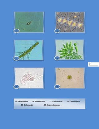 7
25. Ceratolithus 26. Chaetoceros 27. Chaetoceros 28. Characiopsis
29. Chilomastix 30. Chlamydomonas
30
2625
27 28
29
 
