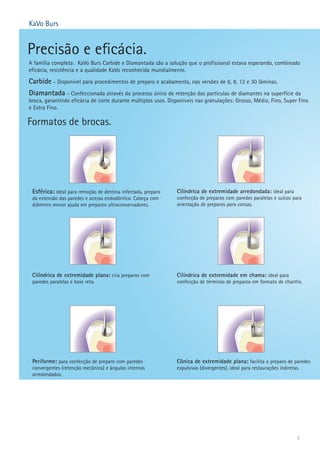 A família completa: KaVo Burs Carbide e Diamantada são a solução que o profissional estava esperando, combinado 
eficácia, resistência e a qualidade KaVo reconhecida mundialmente. 
Carbide – Disponível para procedimentos de preparo e acabamento, nas versões de 6, 8, 12 e 30 lâminas. 
Diamantada – Confeccionada através do processo único de retenção das partículas de diamantes na superfície da 
broca, garantindo eficácia de corte durante múltiplos usos. Disponíveis nas granulações: Grosso, Médio, Fino, Super Fino 
e Extra Fino. 
2 
Precisão e eficácia. 
Formatos de brocas. 
Esférica: ideal para remoção de dentina infectada, preparo 
da extensão das paredes e acesso endodôntico. Cabeça com 
diâmetro menor ajuda em preparos ultraconservadores. 
Cilíndrica de extremidade plana: cria preparos com 
paredes paralelas e base reta. 
Periforme: para confecção de preparo com paredes 
convergentes (retenção mecânica) e ângulos internos 
arredondados. 
Cilíndrica de extremidade arredondada: ideal para 
confecção de preparos com paredes paralelas e sulcos para 
orientação de preparos para coroas. 
Cilíndrica de extremidade em chama: ideal para 
confecção de términos de preparos em formato de chanfro. 
Cônica de extremidade plana: facilita o preparo de paredes 
expulsivas (divergentes), ideal para restaurações indiretas. 
KaVo Burs 
 