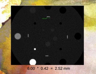 6.00  *  0.42  =  2.52 mm 