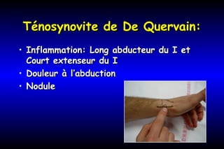 Ténosynovite de De Quervain:Ténosynovite de De Quervain:
• Inflammation: Long abducteur du I etInflammation: Long abducteur du I et
Court extenseur du ICourt extenseur du I
• Douleur à l’abductionDouleur à l’abduction
• NoduleNodule
 