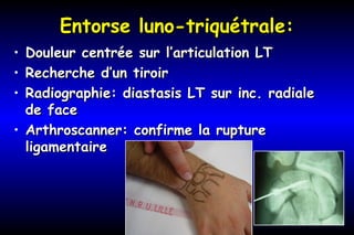 Entorse luno-triquétrale:Entorse luno-triquétrale:
• Douleur centrée sur l’articulation LTDouleur centrée sur l’articulation LT
• Recherche d’un tiroirRecherche d’un tiroir
• Radiographie: diastasis LT sur inc. radialeRadiographie: diastasis LT sur inc. radiale
de facede face
• Arthroscanner: confirme la ruptureArthroscanner: confirme la rupture
ligamentaireligamentaire
 