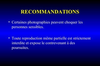 RECOMMANDATIONSRECOMMANDATIONS
• Certaines photographies peuvent choquer les
personnes sensibles.
• Toute reproduction même partielle est strictement
interdite et expose le contrevenant à des
poursuites.
 