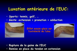 Luxation antérieure de l’EUC:Luxation antérieure de l’EUC:
• Sports: tennis, golf, …Sports: tennis, golf, …
• Geste: extension + pronation + adductionGeste: extension + pronation + adduction
• Rupture de la gaine de l’EUCRupture de la gaine de l’EUC
• Remise en place du tendon en extensionRemise en place du tendon en extension
Effet essuie-glace surEffet essuie-glace sur
l’extrémité de l’ulnal’extrémité de l’ulna
 