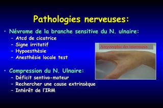 Pathologies nerveuses:Pathologies nerveuses:
• Névrome de la branche sensitive du N. ulnaire:Névrome de la branche sensitive du N. ulnaire:
– Atcd de cicatriceAtcd de cicatrice
– Signe irritatifSigne irritatif
– HypoesthèsieHypoesthèsie
– Anesthésie locale testAnesthésie locale test
• Compression du N. Ulnaire:Compression du N. Ulnaire:
– Déficit sentivo-moteurDéficit sentivo-moteur
– Rechercher une cause extrinsèqueRechercher une cause extrinsèque
– Intérêt de l’IRMIntérêt de l’IRM
Amyotrophie des interosseux
 