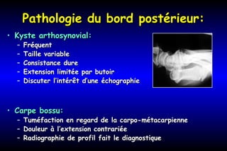 Pathologie du bord postérieur:Pathologie du bord postérieur:
• Kyste arthosynovial:Kyste arthosynovial:
– FréquentFréquent
– Taille variableTaille variable
– Consistance dureConsistance dure
– Extension limitée par butoirExtension limitée par butoir
– Discuter l’intérêt d’une échographieDiscuter l’intérêt d’une échographie
• Carpe bossu:Carpe bossu:
– Tuméfaction en regard de la carpo-métacarpienneTuméfaction en regard de la carpo-métacarpienne
– Douleur à l’extension contrariéeDouleur à l’extension contrariée
– Radiographie de profil fait le diagnostiqueRadiographie de profil fait le diagnostique
 