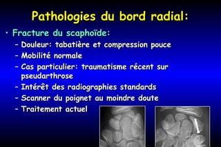 Pathologies du bord radial:Pathologies du bord radial:
• Fracture du scaphoïde:Fracture du scaphoïde:
– Douleur: tabatière et compression pouceDouleur: tabatière et compression pouce
– Mobilité normaleMobilité normale
– Cas particulier: traumatisme récent surCas particulier: traumatisme récent sur
pseudarthrosepseudarthrose
– Intérêt des radiographies standardsIntérêt des radiographies standards
– Scanner du poignet au moindre douteScanner du poignet au moindre doute
– Traitement actuelTraitement actuel
 