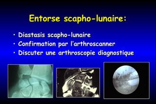 Entorse scapho-lunaire:Entorse scapho-lunaire:
• Diastasis scapho-lunaireDiastasis scapho-lunaire
• Confirmation par l’arthroscannerConfirmation par l’arthroscanner
• Discuter une arthroscopie diagnostiqueDiscuter une arthroscopie diagnostique
 