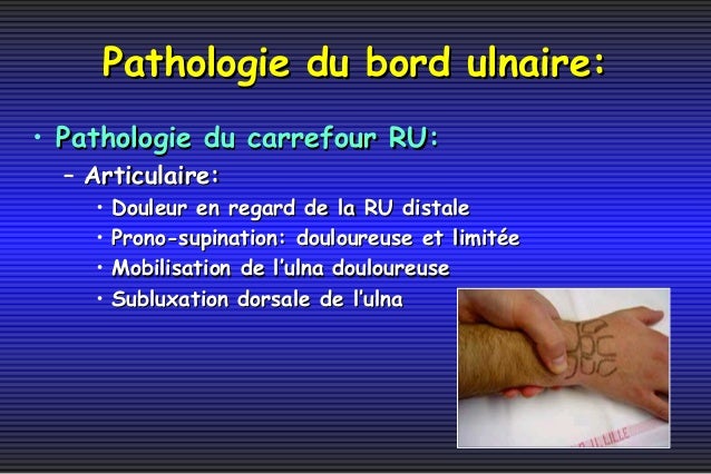 Douleur ulnaire poignet Clearance