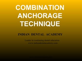 COMBINATION
ANCHORAGE
TECHNIQUE
INDIAN DENTAL ACADEMY
Leader in continuing dental education
www.indiandentalacademy.com

www.indiandentalacademy.com

 