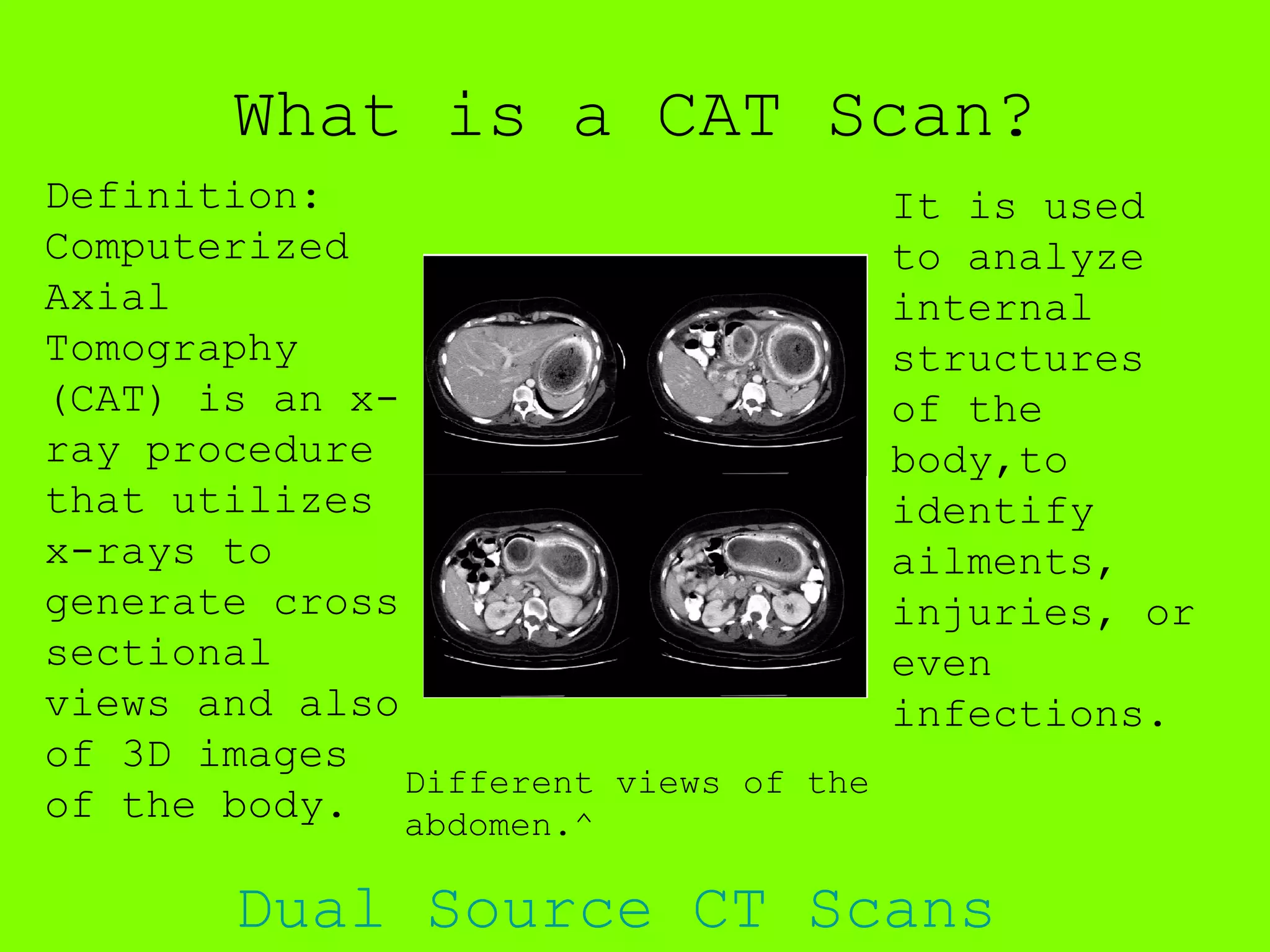 Cat Scans