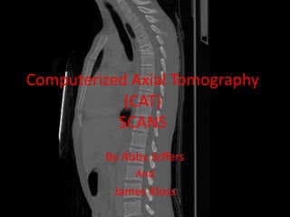 Computerized Axial Tomography
            (CAT)
           SCANS
         By Abby Jeffers
              And
          James Kloss
 
