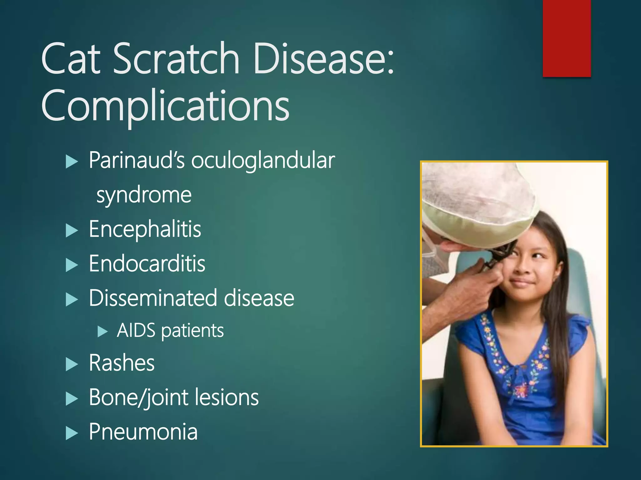 Cat scratch disease | PPTX