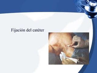 Catéter venoso central