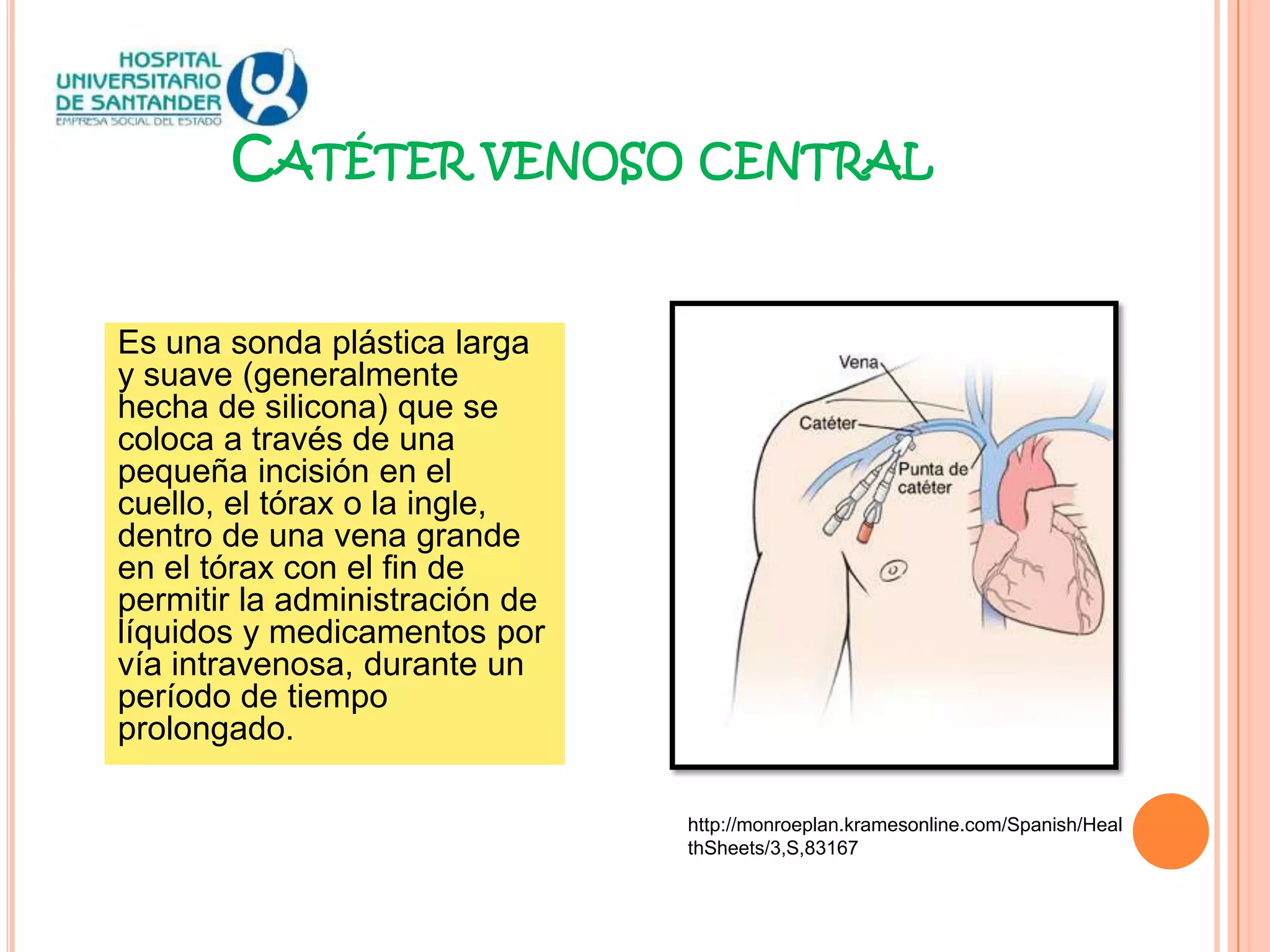 Catéter venoso central | PPTX
