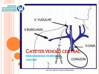 CATÉTER VENOSO CENTRAL
ERIKA VANESSA ROMERO
10021006
http://www.slideshare.net/gramos089/cateteres
 