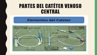 PARTES DEL CATÉTER VENOSO
CENTRAL
 