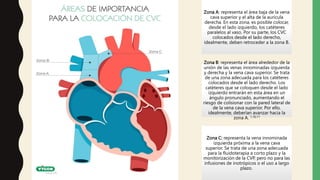 Zona A: representa el área baja de la vena
cava superior y el alta de la aurícula
derecha. En esta zona, es posible colocar,
desde el lado izquierdo, los catéteres
paralelos al vaso. Por su parte, los CVC
colocados desde el lado derecho,
idealmente, deben retroceder a la zona B.
Zona B: representa el área alrededor de la
unión de las venas innominadas izquierda
y derecha y la vena cava superior. Se trata
de una zona adecuada para los catéteres
colocados desde el lado derecho. Los
catéteres que se coloquen desde el lado
izquierdo entrarán en esta área en un
ángulo pronunciado, aumentando el
riesgo de colisionar con la pared lateral de
de la vena cava superior. Por ello,
idealmente, deberían avanzar hacia la
zona A. 1,10,11
Zona C: representa la vena innominada
izquierda próxima a la vena cava
superior. Se trata de una zona adecuada
para la fluidoterapia a corto plazo y la
monitorización de la CVP, pero no para las
infusiones de inotrópicos o el uso a largo
plazo.
 