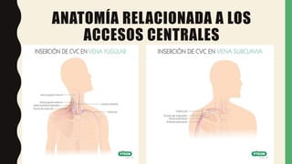 ANATOMÍA RELACIONADA A LOS
ACCESOS CENTRALES
 