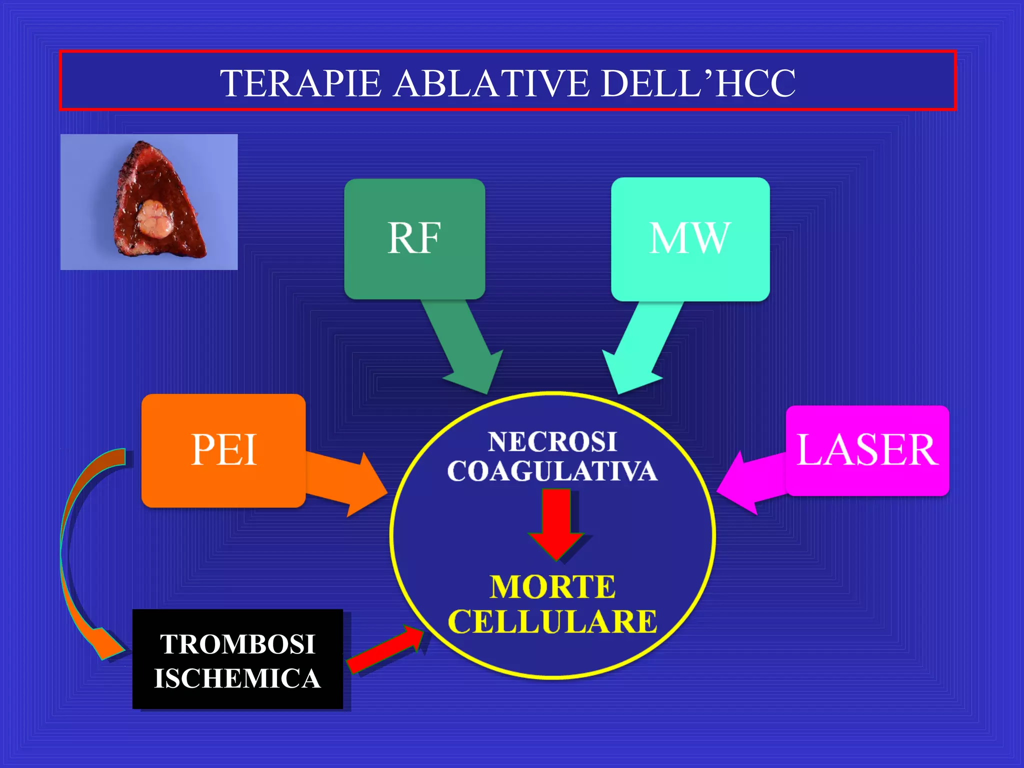 Caturelli E. L'Ecografia Operativa. ASMaD 2016 | PPT
