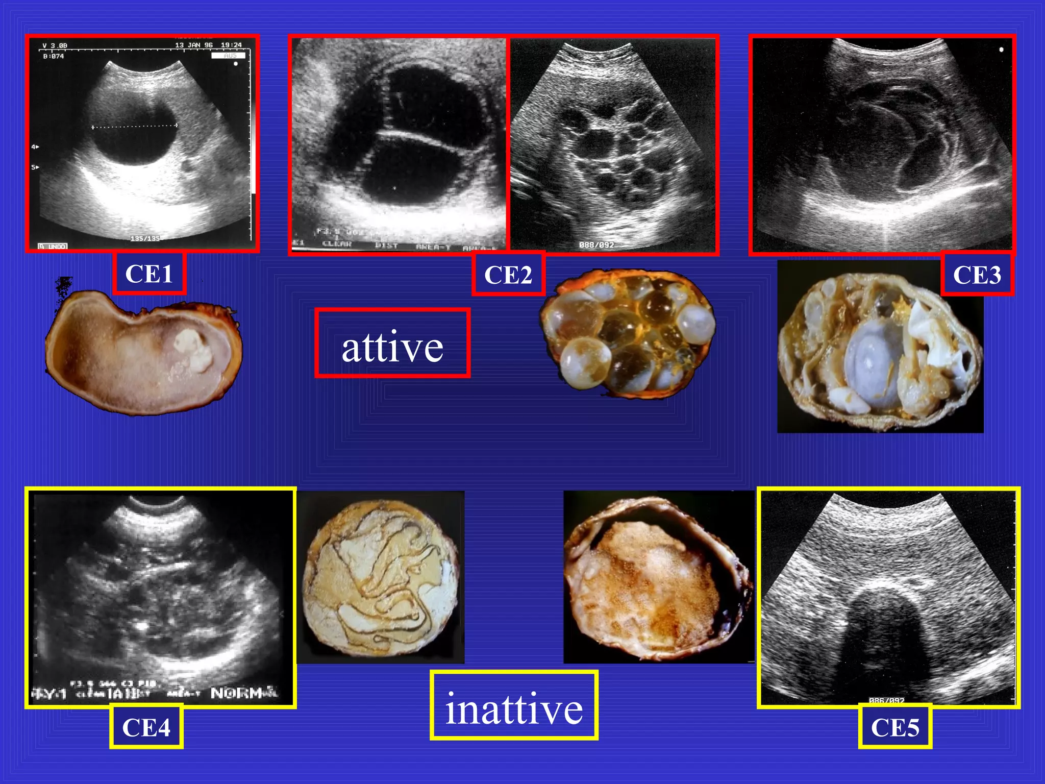 Caturelli E. L'Ecografia Operativa. ASMaD 2016 | PPT
