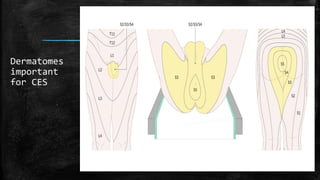 Dermatomes
important
for CES
 