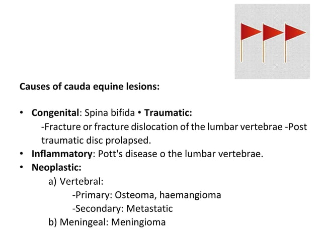 Image showcasing cauda equina syndrome 2021 (lumbar) .pdf
