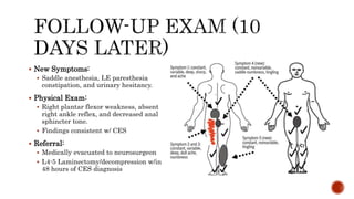 Cauda equina syndrome 