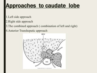 Approaches to caudate lobe
1.Left side approach
2.Right side approach
3.The combined approach ( combination of left and right)
4.Anterior Transhepatic approach
 
