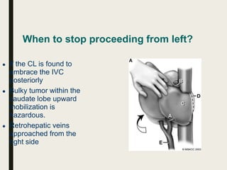 When to stop proceeding from left?
● If the CL is found to
embrace the IVC
posteriorly
● Bulky tumor within the
caudate lobe upward
mobilization is
hazardous.
● Retrohepatic veins
approached from the
right side
 